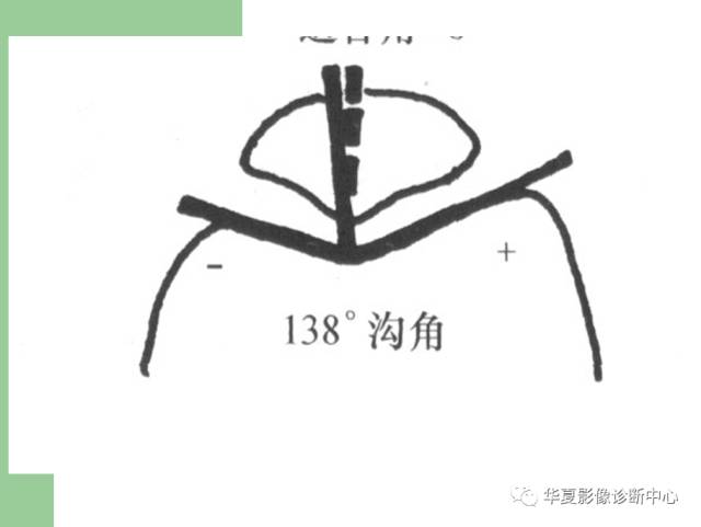 【PPT】髌骨高位