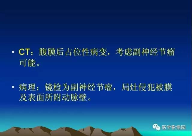 【病例】腹膜后副神经节瘤1例CT影像表现