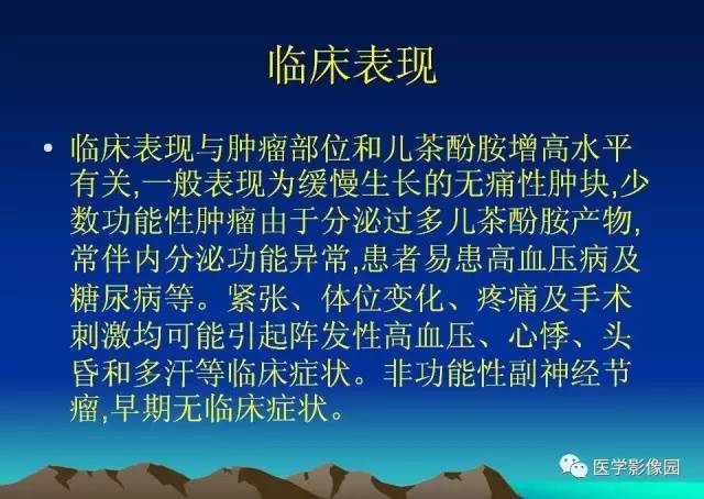 【病例】腹膜后副神经节瘤1例CT影像表现