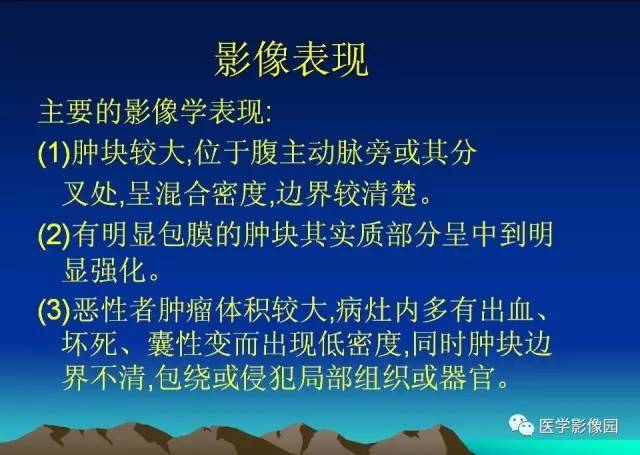 【病例】腹膜后副神经节瘤1例CT影像表现