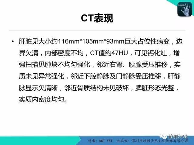 【病例】肝母细胞瘤1例CT影像表现