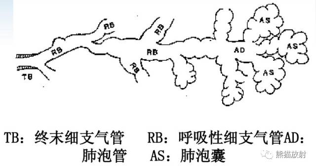肺气肿的“千姿百态”! 肺气肿的“千姿百态”!