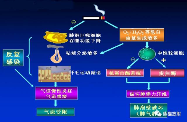 肺气肿的“千姿百态”! 肺气肿的“千姿百态”!