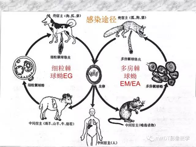 颅内感染性疾病——寄生虫病