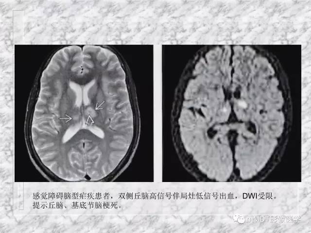 颅内感染性疾病——寄生虫病