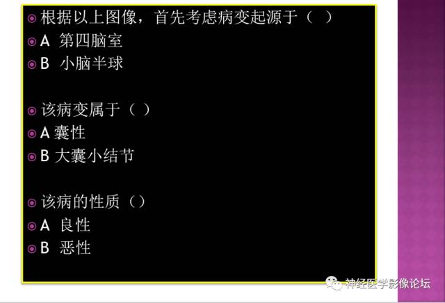 【病例】表皮样囊肿1例MR影像表现