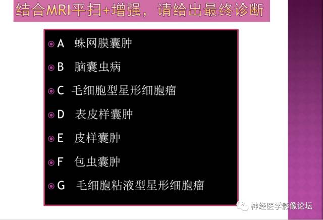 【病例】表皮样囊肿1例MR影像表现