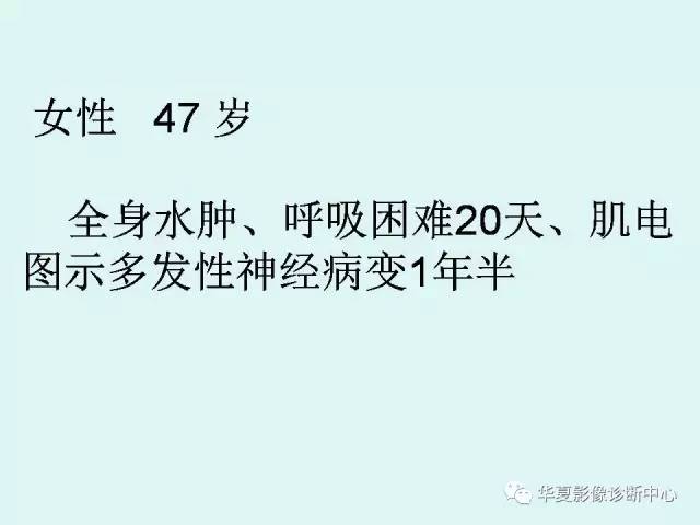 【病例】POEMS综合征一例CT