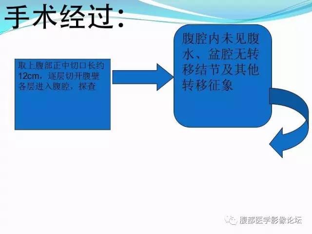 【病例】胃炎性纤维性息肉1例CT 【病例】胃炎性纤维性息肉1例CT