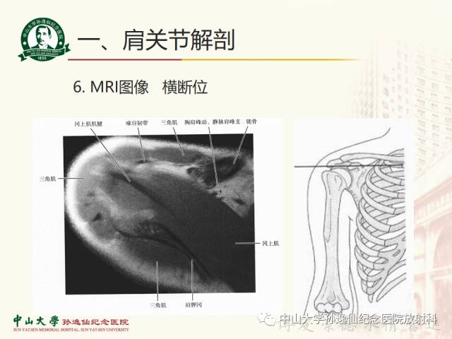 【PPT】肩关节解剖及常见病的MRI诊断