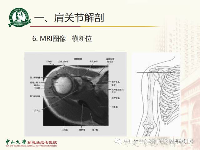 【PPT】肩关节解剖及常见病的MRI诊断