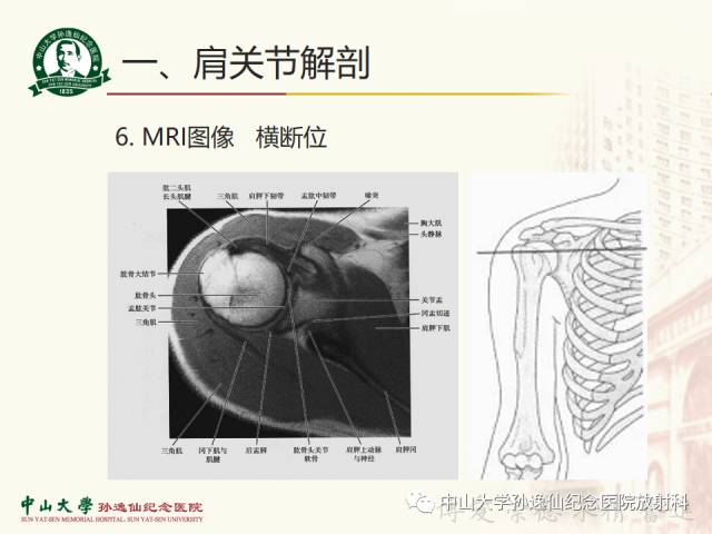 【PPT】肩关节解剖及常见病的MRI诊断