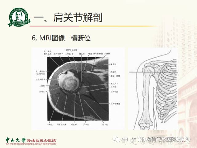 【PPT】肩关节解剖及常见病的MRI诊断
