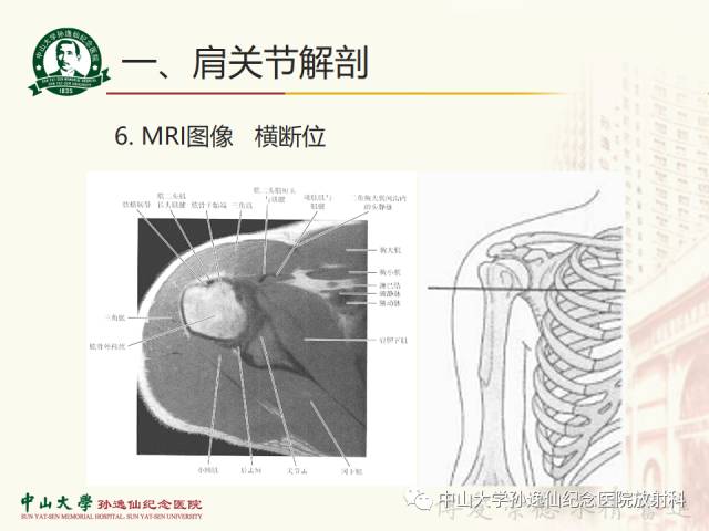 【PPT】肩关节解剖及常见病的MRI诊断