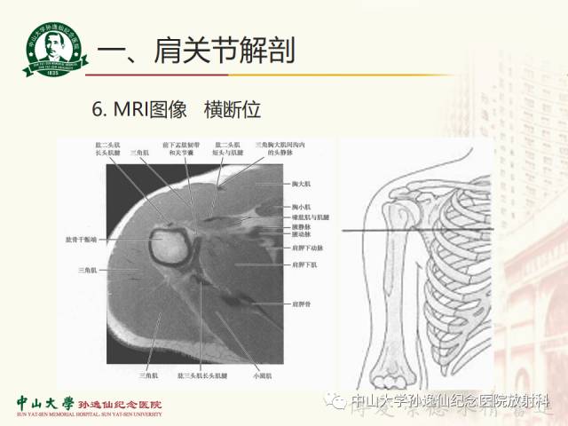 【PPT】肩关节解剖及常见病的MRI诊断