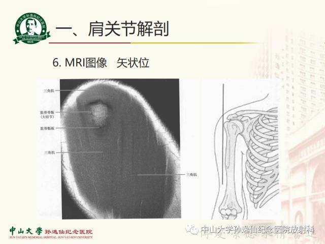 【PPT】肩关节解剖及常见病的MRI诊断