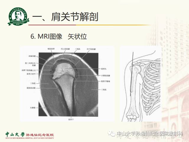 【PPT】肩关节解剖及常见病的MRI诊断
