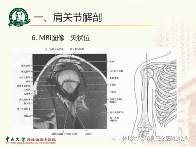 【PPT】肩关节解剖及常见病的MRI诊断