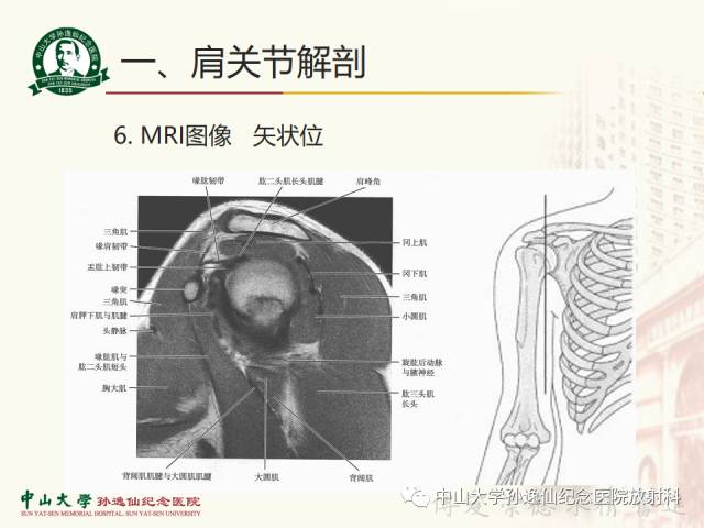 【PPT】肩关节解剖及常见病的MRI诊断