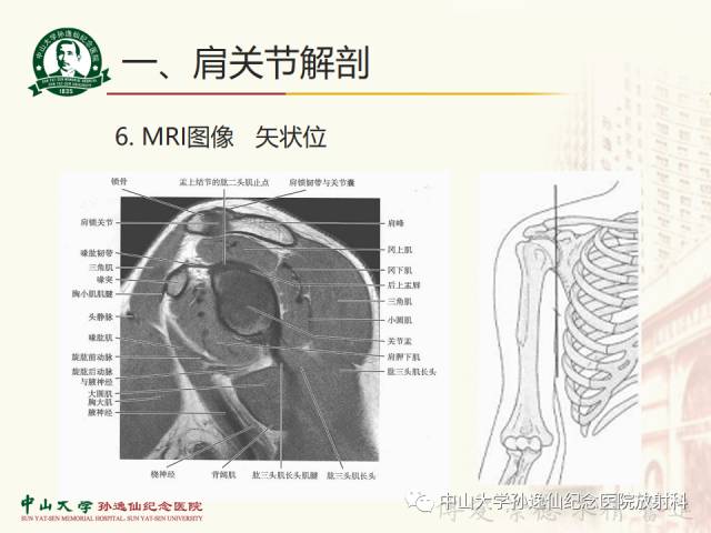 【PPT】肩关节解剖及常见病的MRI诊断