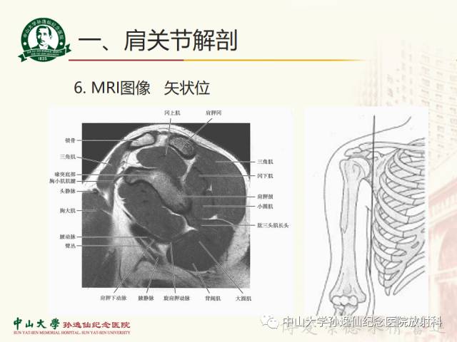 【PPT】肩关节解剖及常见病的MRI诊断