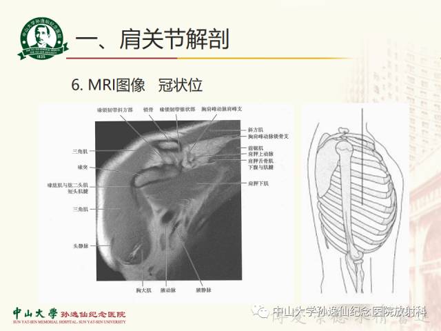 【PPT】肩关节解剖及常见病的MRI诊断