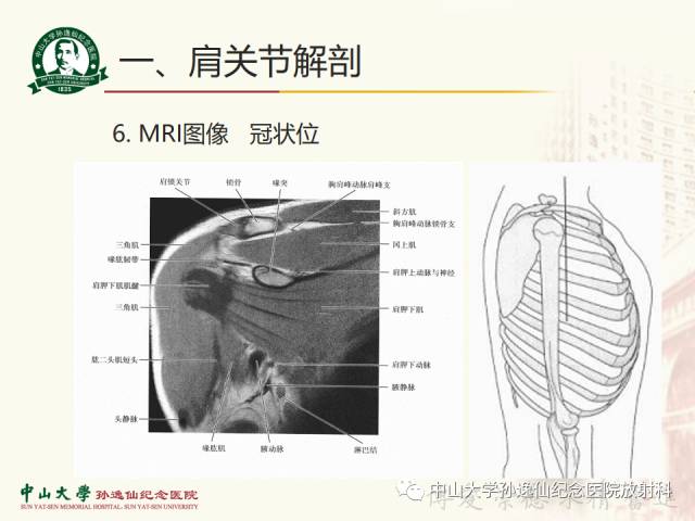 【PPT】肩关节解剖及常见病的MRI诊断