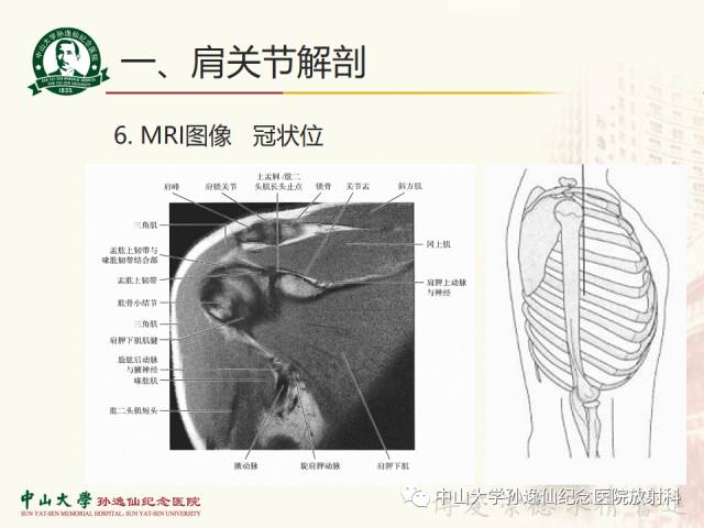 【PPT】肩关节解剖及常见病的MRI诊断