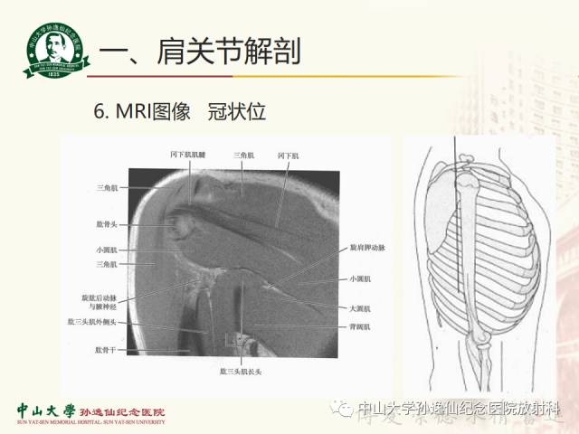 【PPT】肩关节解剖及常见病的MRI诊断