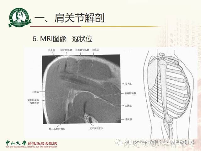 【PPT】肩关节解剖及常见病的MRI诊断