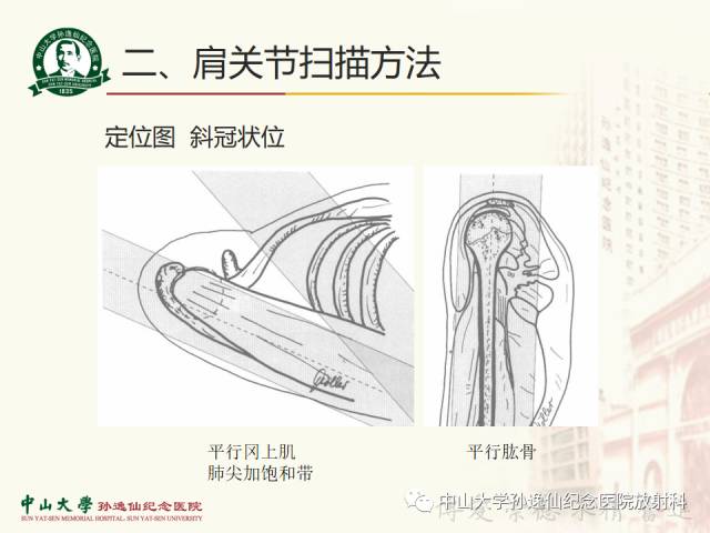 【PPT】肩关节解剖及常见病的MRI诊断