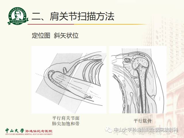 【PPT】肩关节解剖及常见病的MRI诊断