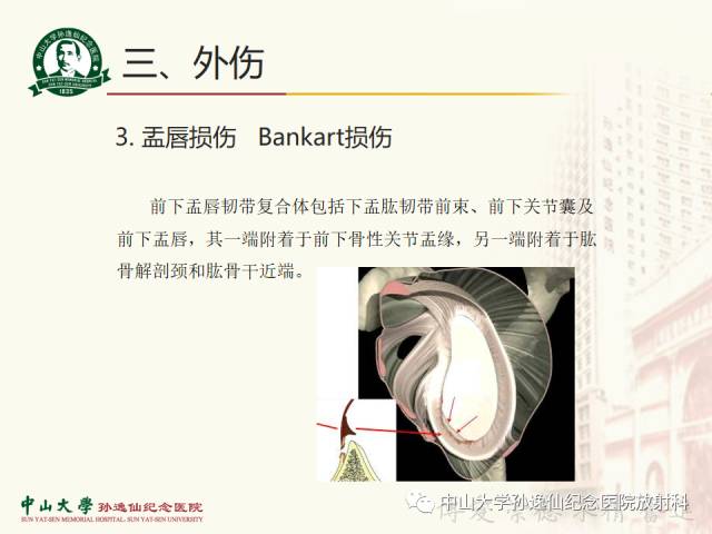 【PPT】肩关节解剖及常见病的MRI诊断