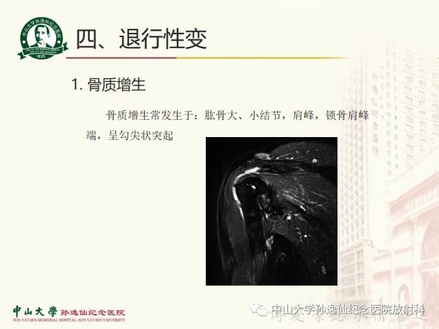 【PPT】肩关节解剖及常见病的MRI诊断