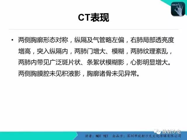 【病例】纵膈疝1例X线CT影像表现