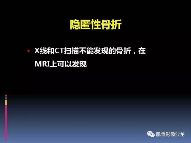 【PPT】膝关节病变影像学诊断