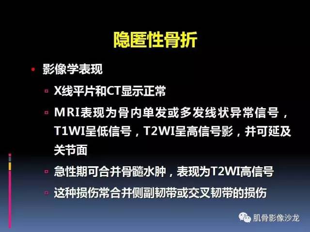 【PPT】膝关节病变影像学诊断