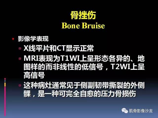 【PPT】膝关节病变影像学诊断