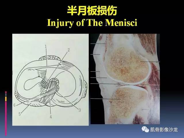 【PPT】膝关节病变影像学诊断