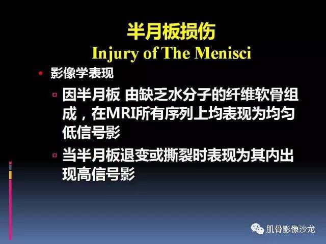 【PPT】膝关节病变影像学诊断