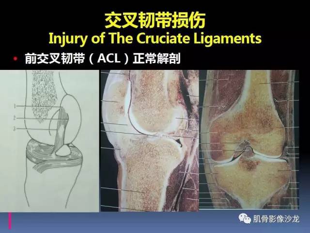 【PPT】膝关节病变影像学诊断