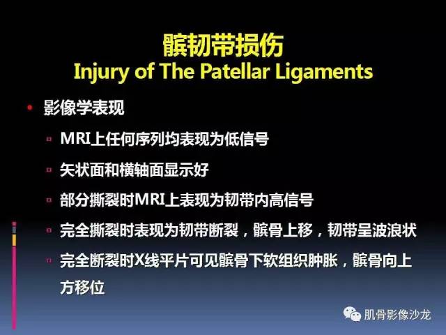【PPT】膝关节病变影像学诊断