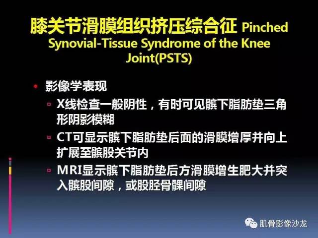 【PPT】膝关节病变影像学诊断