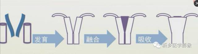 子宫发育异常,应想到的6大类常见畸形 子宫发育异常,应想到的6大类常见畸形