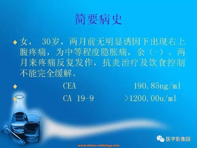 【病例】胆囊癌1例CT影像表现