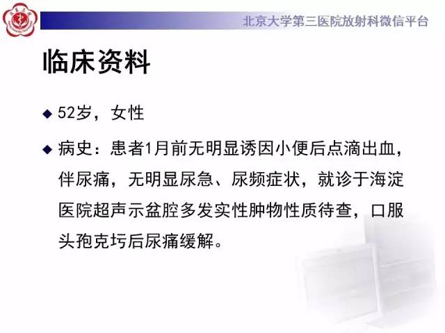 【病例】静脉内平滑肌瘤病1例CT及MR
