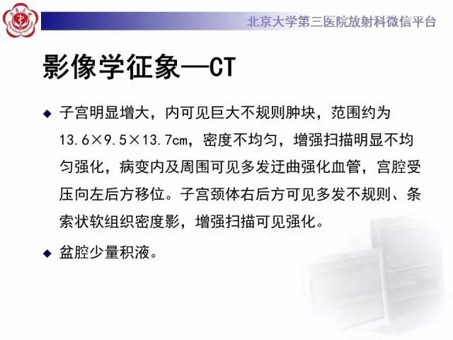 【病例】静脉内平滑肌瘤病1例CT及MR
