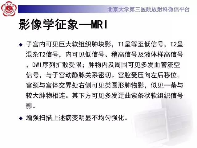 【病例】静脉内平滑肌瘤病1例CT及MR