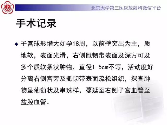 【病例】静脉内平滑肌瘤病1例CT及MR