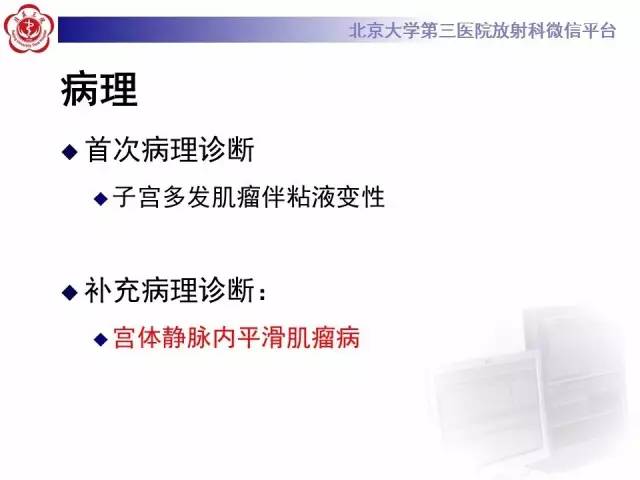 【病例】静脉内平滑肌瘤病1例CT及MR